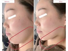 エミレビューティーサロン(emire beauty salon)