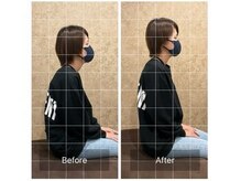 トラスト整体院 住吉院/30代/女性/デスクワーク/猫背