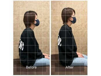 トラスト整体院 住吉院/30代/女性/デスクワーク/猫背