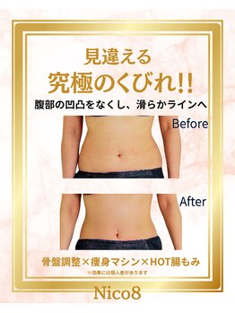 ニコエイト(Nico8)の写真/痩せない原因は［骨格］かも？土台から整える根本改善ダイエット！