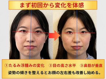 メディピークス/初回の変化