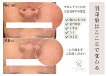 ヴィヴォラ(VIVORA)