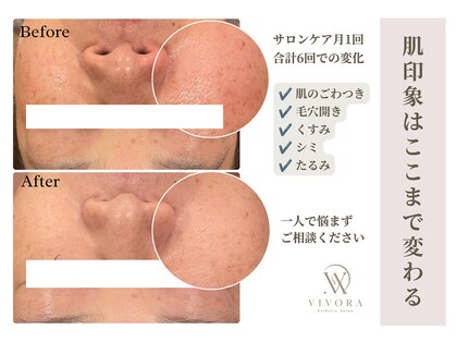 ヴィヴォラ(VIVORA)の写真
