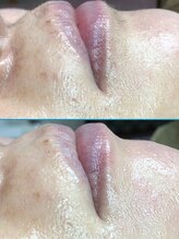 エンジェルワックス 蒲田店(Angel Wax)/【フェイスワックス】