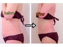 アンリール 旭川店(Anrire)/BODY施術のお客様です！