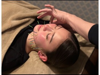 フォーユー 大安寺院(for you)/美容鍼灸