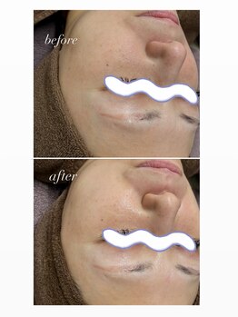 スマイルネイル(SMILE NAIL)/