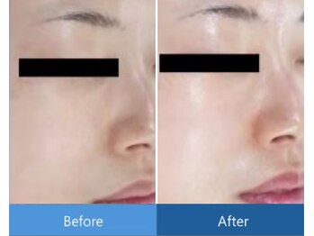 ローズドゥシャロン(Rose de CHALON)/キメも整いなめらかな肌に★