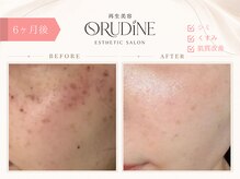 オルディーネ(ORUDiNE)
