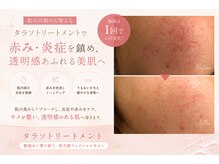 ジ.インペリアル 金山駅店(G.IMPERIAL)の雰囲気(幹細胞を使用した人気のトリートメント、しっかりした肌結果が。)