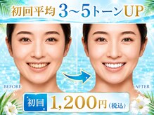 ココホワイトニング 天王寺店