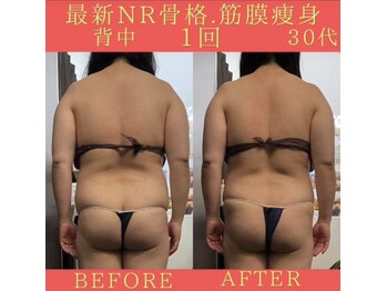 リラクゼーションサロン ラキ(laki)/NR筋膜骨格調整1回