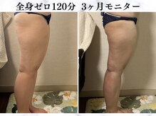 シーフェイス 横浜店(SEE FACE)/全身ゼロダイエットモニター様