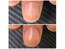 当たり前だと思っていた爪が、見違えるほどの爪へ