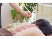 佳園の雰囲気（大人気吸玉深い巡りケアで、施術後のスッキリ感が格段にUP）