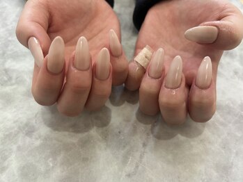 ヌールプラス(NU-RU+)/定額A