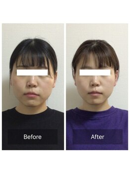 ココリル(cocorire)/3D小顔矯正