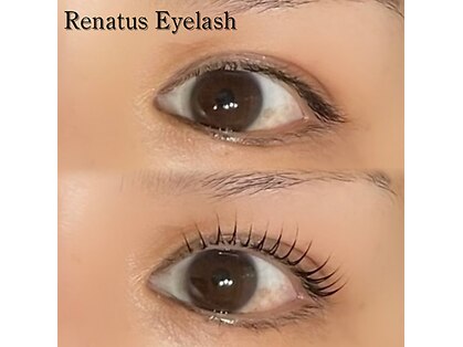 レナトゥス アイラッシュ(Renatus Eyelash)の写真