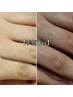 《レディース限定》【ひじ下＋手の甲＋手の指】¥6100