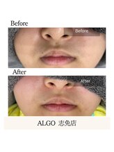 アルゴ 志免店(ALGO)/あなたのお子様のお悩み