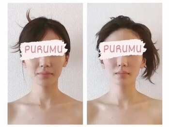 プルム(PURUMU)の写真/鏡を見るたびガッカリしていませんか？骨格矯正で深層からお顔を整え、自信が持てる若々しい印象へ