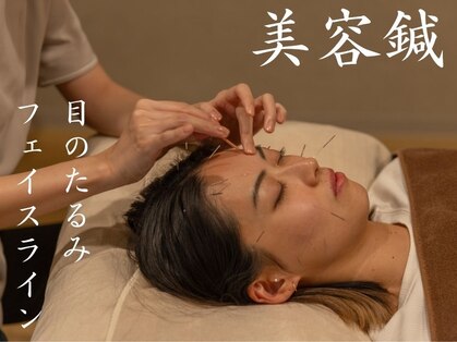 はり結の写真