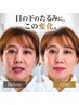 目の下たるみクマ【疲れて見える目元をコンシーラー要らずに】小顔矯正60分