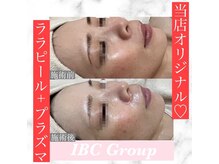 トータルサロンアイビーシー(トータルサロンIBC)の雰囲気（大人気のララピール！韓国で開発者から直接習った講師が在籍）