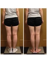 プラスファイン(+fine)/おすすめO脚矯正。後ろ