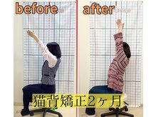 きずな鍼灸整骨院 武蔵ヶ丘本院/猫背矯正での途中経過