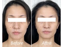 ドクターボディ 新宿店(Dr.Body)/【面長/左右差　30代】