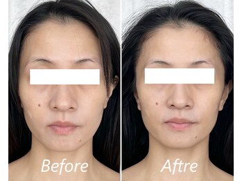 ドクターボディ 新宿店(Dr.Body)/【面長/左右差 30代】