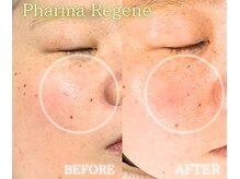 レイネ(REINE)/ファーマリジェネ/美肌三大要素