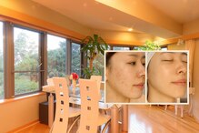 アンナビューティーサロン 博多店