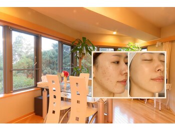 アンナビューティーサロン 博多店