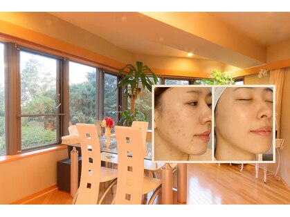 アンナビューティーサロン 博多店の写真