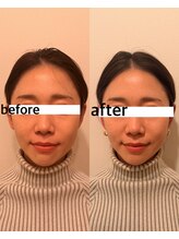 ココ アブリス(coco Abliss)/