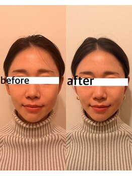 ココ アブリス(coco Abliss)/