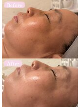 エステサロン アンジュール(Angelle)/Before→After