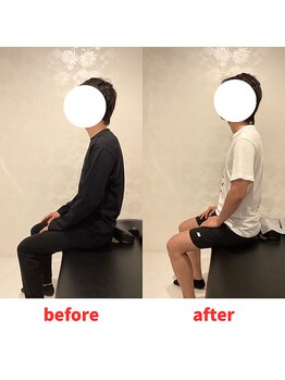 ナオル整体 福岡香椎院(NAORU整体)/30代男性施術事例【猫背】