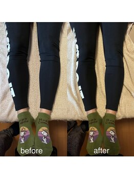 カイロプラクティック ネクサス/Ｏ脚撃退☆