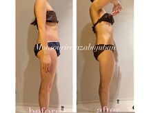 モンスリール 麻布十番(Mon Sourire)/ハイパーシェイプ