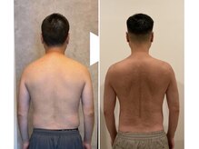 TMサロン 赤坂/毎週1回の施術で激変！