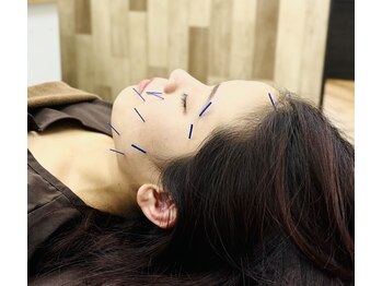 502鍼灸院/美容鍼