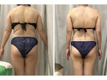 クリスタルミー 横須賀(Crystal me)/体型、むくみ、お疲れ、不調に◎