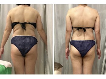 クリスタルミー 横須賀(Crystal me)/体型、むくみ、お疲れ、不調に◎