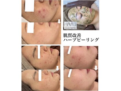 ミベル(MeBell)の写真