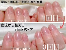 リミーネイルズ(rimiynails)の雰囲気（繰り返さない深爪!ネイルを楽しみながら内側からしっかりと育成）