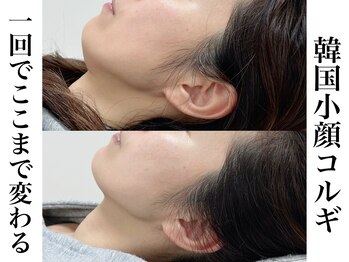 リベルキョウト 京都駅前店(Liber Kyoto)/韓国小顔コルギ