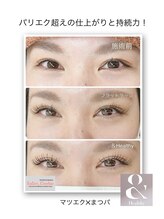 サロン ドット クッキー 塚本(Salon.Cookie)/＆Healthyビフォアフ